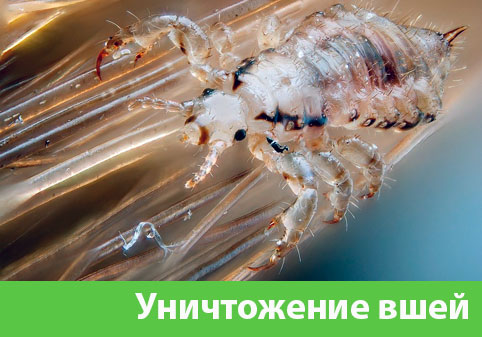 Уничтожение вшей в городе Волгоград